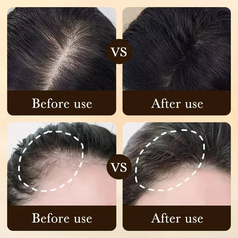 RevitaGrow Hair Serum